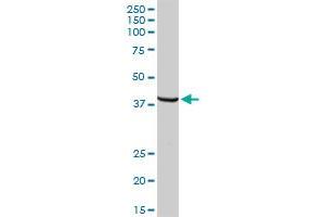 TPBG MaxPab rabbit polyclonal antibody. (TPBG antibody  (AA 1-420))