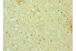Immunohistochemistry of paraffin-embedded human brain tissue using ABIN7150804 at dilution of 1:100 (Dynactin 1 antibody  (AA 1084-1278))