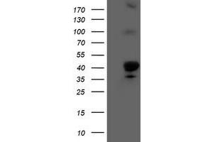 HEK293T cells were transfected with the pCMV6-ENTRY control (Left lane) or pCMV6-ENTRY HMOX2 (Right lane) cDNA for 48 hrs and lysed. (HMOX2 antibody)