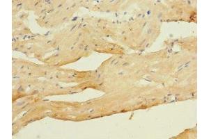 Immunohistochemistry of paraffin-embedded human heart tissue using ABIN7175582 at dilution of 1:100