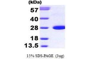 SDS-PAGE (SDS) image for Calbindin (CALB1) (AA 1-261) protein (ABIN666890)