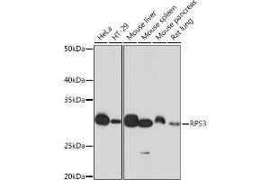 Western blot analysis of extracts of various cell lines, using RPS3 Rabbit mAb (ABIN7270025) at 1:1000 dilution. (RPS3 antibody)