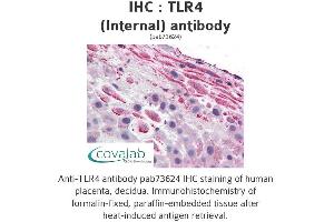 Image no. 1 for anti-Toll-Like Receptor 4 (TLR4) (Internal Region) antibody (ABIN1740115) (TLR4 antibody  (Internal Region))