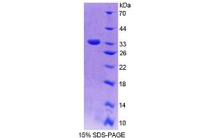 SDS-PAGE (SDS) image for NAD(P)H Dehydrogenase, Quinone 1 (NQO1) (AA 2-273) protein (His tag) (ABIN6236473) (NQO1 Protein (AA 2-273) (His tag))