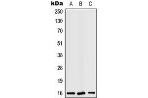 Western blot analysis of RPS19 expression in K562 (A), Raw264. (RPS19 antibody  (Center))
