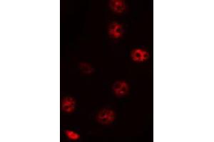 ABIN6272469 staining HepG2 by IF/ICC. (ZNF785 antibody)