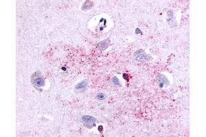 Anti-PAK6 antibody IHC of human brain, neurons and glia. (PAK6 antibody  (Linker Domain))