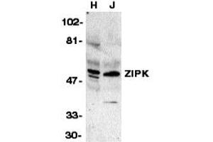 Western Blotting (WB) image for anti-Death-Associated Protein Kinase 3 (DAPK3) (Middle Region) antibody (ABIN1031183) (DAPK3 antibody  (Middle Region))