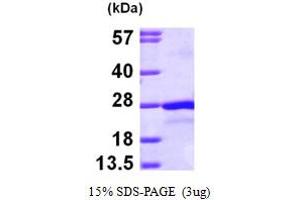 SDS-PAGE (SDS) image for Protein tyrosine Phosphatase Type IVA, Member 2 (PTP4A2) (AA 1-167) protein (His tag) (ABIN5779760)
