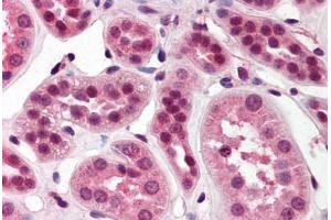 Human Kidney (formalin-fixed, paraffin-embedded) stained with SKI antibody ABIN214477 at 2. (SKI antibody  (N-Term))