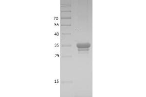 Western Blotting (WB) image for Mitogen-Activated Protein Kinase Kinase 1 (MAP2K1) (AA 1-58) protein (GST tag) (ABIN7281820) (MEK1 Protein (AA 1-58) (GST tag))