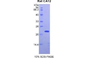 SDS-PAGE analysis of Rat CA12 Protein. (CA12 Protein)