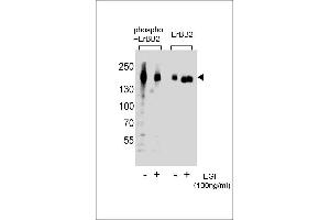 Western blot analysis of extracts from A431 cells, untreated or treated with EGF, 100 ng/mL, using Phospho-ERBB2- or ERBB2 Antibody (right). (ErbB2/Her2 antibody  (pTyr1127))