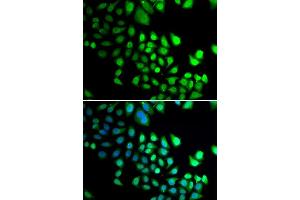 Immunofluorescence analysis of U2OS cells using RBBP5 antibody (ABIN5974189). (RBBP5 antibody)