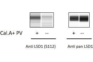 Jurkat cells were treated with Calyculin A and Pervanadate. (LSD1 ELISA Kit)