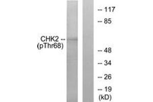 Western blot analysis of extracts from Jurkat cells treated with UV, using Chk2 (Phospho-Thr68) Antibody. (CHEK2 antibody  (pThr68))