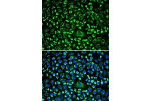 Immunofluorescence analysis of HeLa cells using TAPBP antibody (ABIN6132744, ABIN6148847, ABIN6148849 and ABIN6217320). (TAPBP antibody  (AA 30-260))
