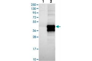 Western blot analysis of Lane 1: Negative control (vector only transfected HEK293T lysate), Lane 2: Over-expression Lysate (Co-expressed with a C-terminal myc-DDK tag (~3. (HARBI1 antibody)
