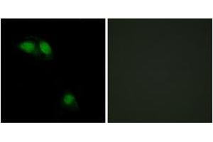 Immunofluorescence analysis of HeLa cells, using IRS-1 (Phospho-Ser312) Antibody. (IRS1 antibody  (pSer312))