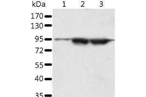 Western Blot analysis of A549 and lncap cell, Human seminoma tissue using SPATA20 Polyclonal Antibody at dilution of 1:1000 (SPATA20 antibody)