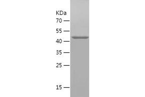 SQLE Protein (AA 49-275) (His-IF2DI Tag)