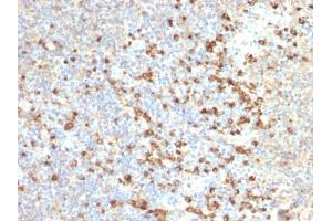 Formalin-fixed, paraffin-embedded human Tonsil stained with TIM3 Mouse Monoclonal Antibody (TIM3/2399). (TIM3 antibody  (AA 22-202))