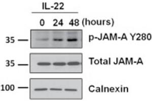 Western Blotting (WB) image for anti-F11 Receptor (F11R) (pTyr280) antibody (ABIN5706868)