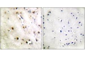 Immunohistochemistry analysis of paraffin-embedded human brain tissue, using TISB (Ab-92) Antibody. (ZFP36L1 antibody  (AA 58-107))