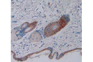 Used in DAB staining on fromalin fixed paraffin- embedded skin tissue (BOC antibody  (AA 668-866))