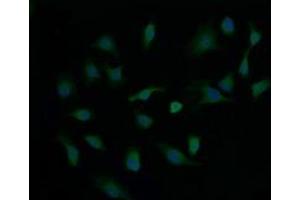 Image no. 1 for anti-Cancer/testis Antigen 1B (CTAG1B) antibody (ABIN1499895) (CTAG1B antibody)