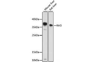 Western blot analysis of extracts of various cell lines using RHD Polyclonal Antibody at dilution of 1:1000. (RHD antibody)