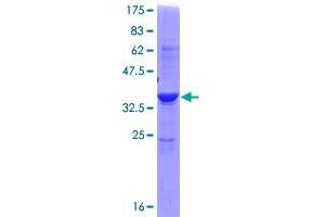 ADI1 Protein (AA 1-179) (GST tag)