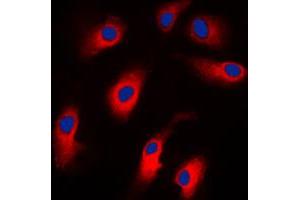 Immunofluorescent analysis of Caspase 7 staining in Jurkat cells. (Caspase 7 antibody  (N-Term))