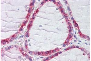 Human Thyroid (formalin-fixed, paraffin-embedded) stained with CLIP1 antibody ABIN462301 followed by biotinylated secondary antibody, alkaline phosphatase-streptavidin and chromogen. (CLIP1 antibody  (AA 1404-1417))