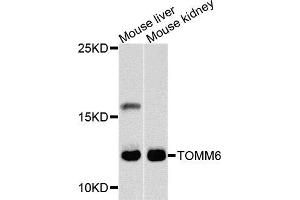 Western blot analysis of extracts of mouse liver and mouse kidney cells, using TOMM6 antibody. (TOMM6 antibody)