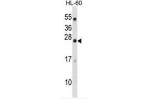 C18orf26 Antibody (N-term) western blot analysis in HL-60 cell line lysates (35µg/lane). (DYNAP antibody  (N-Term))