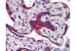 Immunohistochemistry (IHC) image for anti-FEZ Family Zinc Finger 1 (FEZF1) (C-Term) antibody (ABIN2784171)