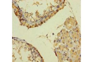 Immunohistochemistry of paraffin-embedded human testis tissue using ABIN7164521 at dilution of 1:100 (SMARCA2 antibody  (AA 700-1216))