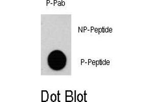 Image no. 1 for anti-Ribosomal Protein S6 Kinase, 90kDa, Polypeptide 3 (RPS6KA3) (pSer369) antibody (ABIN358394) (RPS6KA3 antibody  (pSer369))