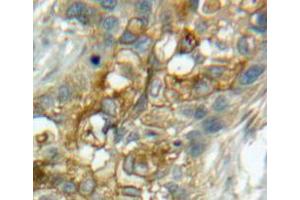 Used in DAB staining on fromalin fixed paraffin-embedded lung tissue (CD93 antibody  (AA 82-369))