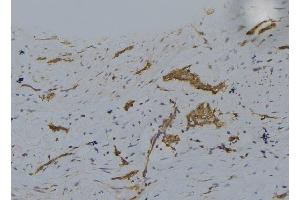 ABIN6277730 at 1/100 staining Human lung tissue by IHC-P. (LATS1 antibody  (Internal Region))