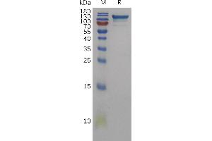 SDS-PAGE (SDS) image for Sema Domain, Immunoglobulin Domain (Ig), Transmembrane Domain (TM) and Short Cytoplasmic Domain, (Semaphorin) 4D (SEMA4D) (AA 22-734) protein (His tag) (ABIN7491189)