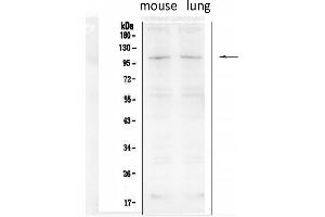 Western blot analysis of TRPC6 using anti- TRPC6 antibody . (TRPC6 antibody  (Middle Region))