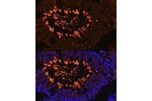 Immunofluorescence analysis of Rat testis using  antibody (ABIN7265353) at dilution of 1:100. (AKAP4 antibody  (AA 189-340))