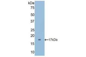 Detection of Recombinant CUBN, Rat using Polyclonal Antibody to Cubilin (CUBN) (CUBN antibody  (AA 3157-3274))