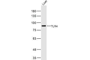 Mouse Liver lysates probed with TLR4 Polyclonal Antibody, Unconjugated  at 1:300 dilution and 4˚C overnight incubation. (TLR4 antibody  (AA 121-200))