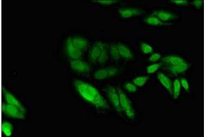 Immunofluorescent analysis of Hela cells using ABIN7150955 at dilution of 1:100 and Alexa Fluor 488-congugated AffiniPure Goat Anti-Rabbit IgG(H+L) (EGR2 antibody  (AA 42-245))