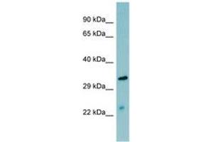 Image no. 1 for anti-Mannan-Binding Lectin serine Peptidase 2 (MASP2) (AA 35-84) antibody (ABIN6741648) (MASP2 antibody  (AA 35-84))