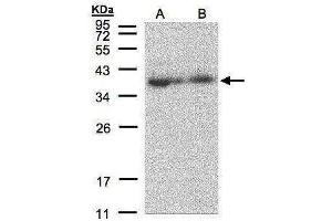 WB Image Sample(30 μg of whole cell lysate) A:293T B:A431, 12% SDS PAGE antibody diluted at 1:500