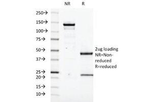 SDS-PAGE Analysis of Purified, BSA-Free Transglutaminase 2 Antibody (clone TGM2/419). (Transglutaminase 2 antibody)